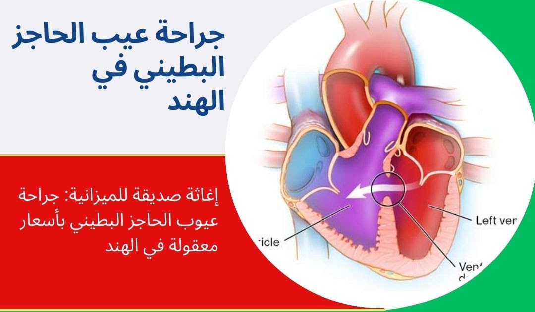 الامارات الى الهند رحلة الطب 4 الصحة: كيف تعد جراحة عيب الحاجز البطيني في الهند الخيار الأفضل لمرضى كينيا