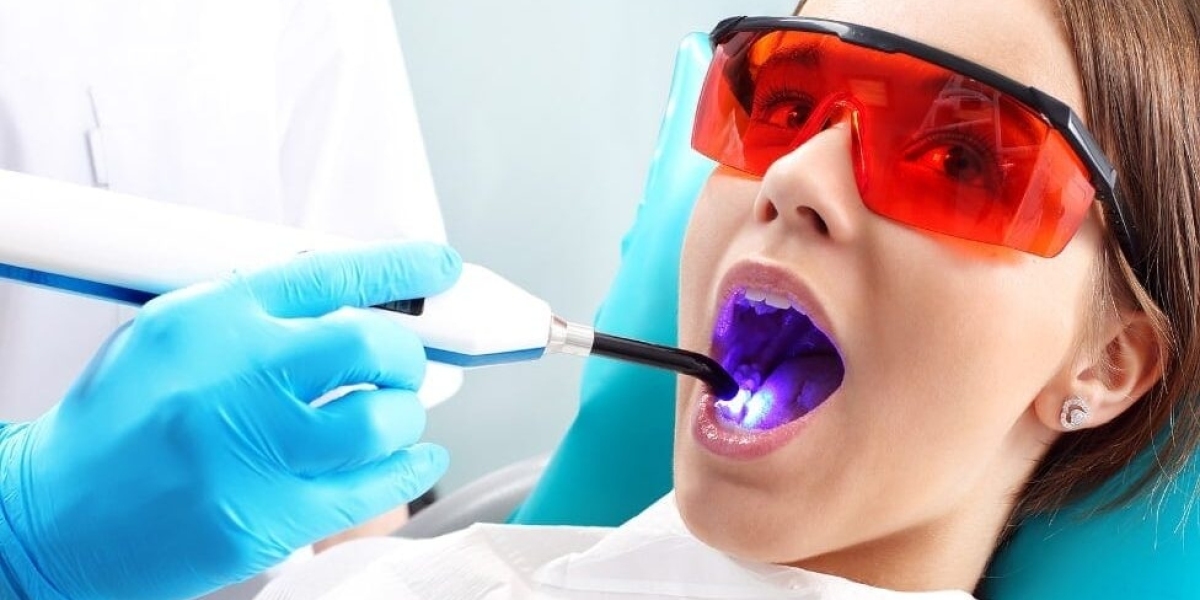 Everything You Need to Know About Dental Bonding in Las Vegas