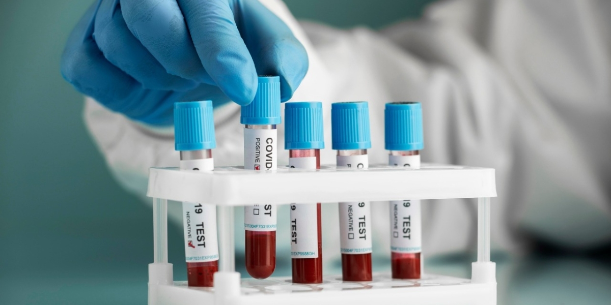 Comprehensive Guide to Blood Test in Bangalore: Affordable and Reliable Options